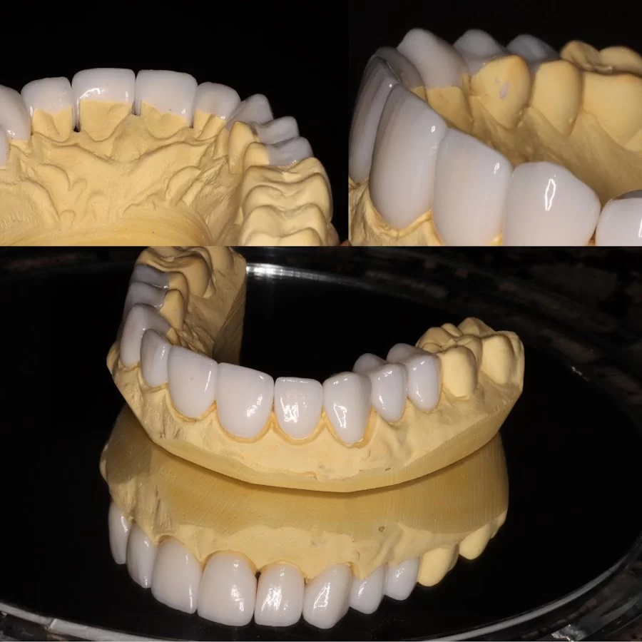 Alexander Family Dentistry: Hannah Alexander DDS Picture 8