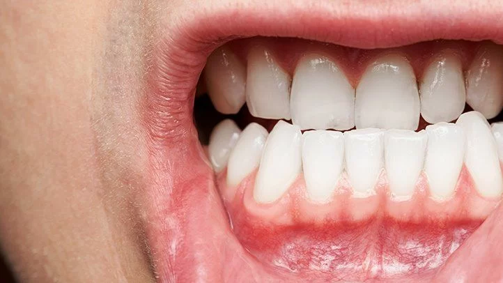 Understanding the Link Between Gum Disease and Diabetes: How Oral Health Affects Diabetes