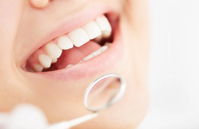 Comprehensive Guide to Tooth Extraction: What You Need to Know