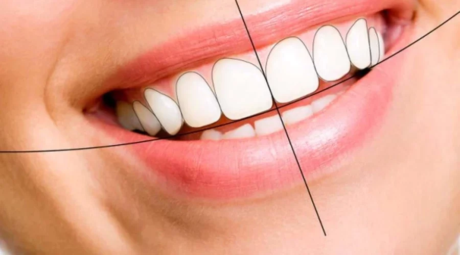 Digital Smile Design Services: Transform Your Smile with Advanced Technology