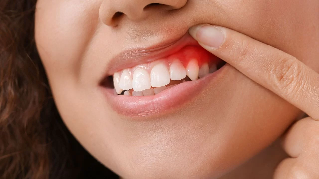 Periodontal Treatments for Bleeding Gums: How to Manage and Prevent Gum Issues