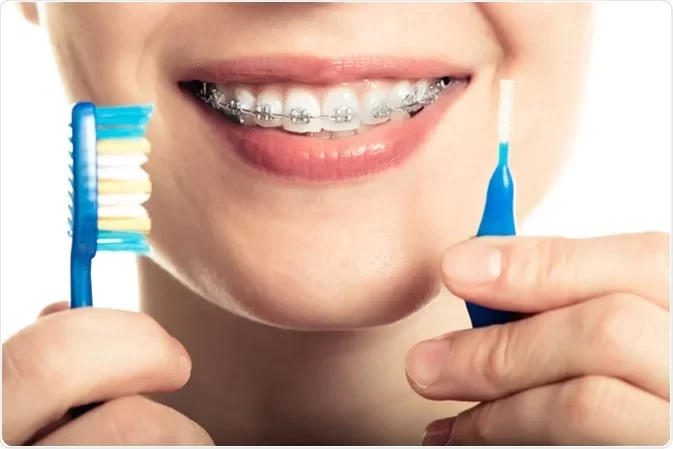 How to Improve Oral Hygiene if You Wear Braces