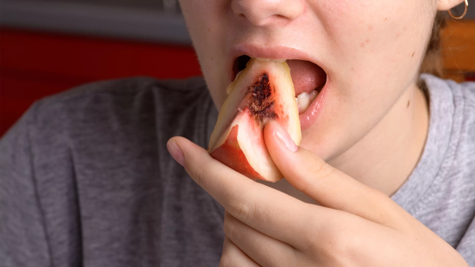 How Eating Habits Can Prevent or Exacerbate Gum Disease: Diet Tips for Healthy Gums