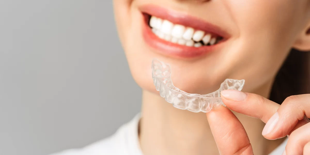 Best At-Home Teeth Whitening Kits: Effective Solutions for a Brighter Smile