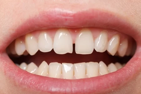 Signs of Good Oral Health: Recognize the Signs of a Healthy Mouth