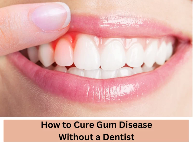 How to Treat Gum Infection at Home