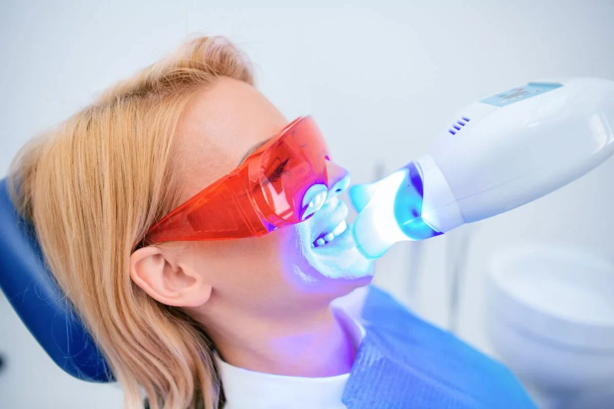 What is the Cost of Teeth Whitening at the Dentist? A Complete Guide to Professional Whitening Prices