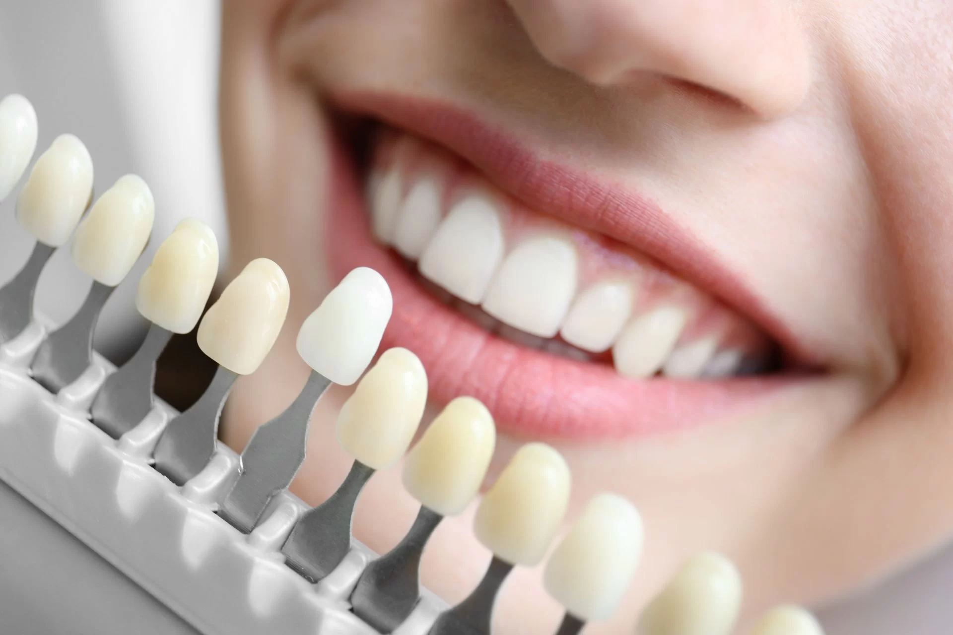 Are Cosmetic Dental Procedures Covered by Insurance? Everything You Need to Know