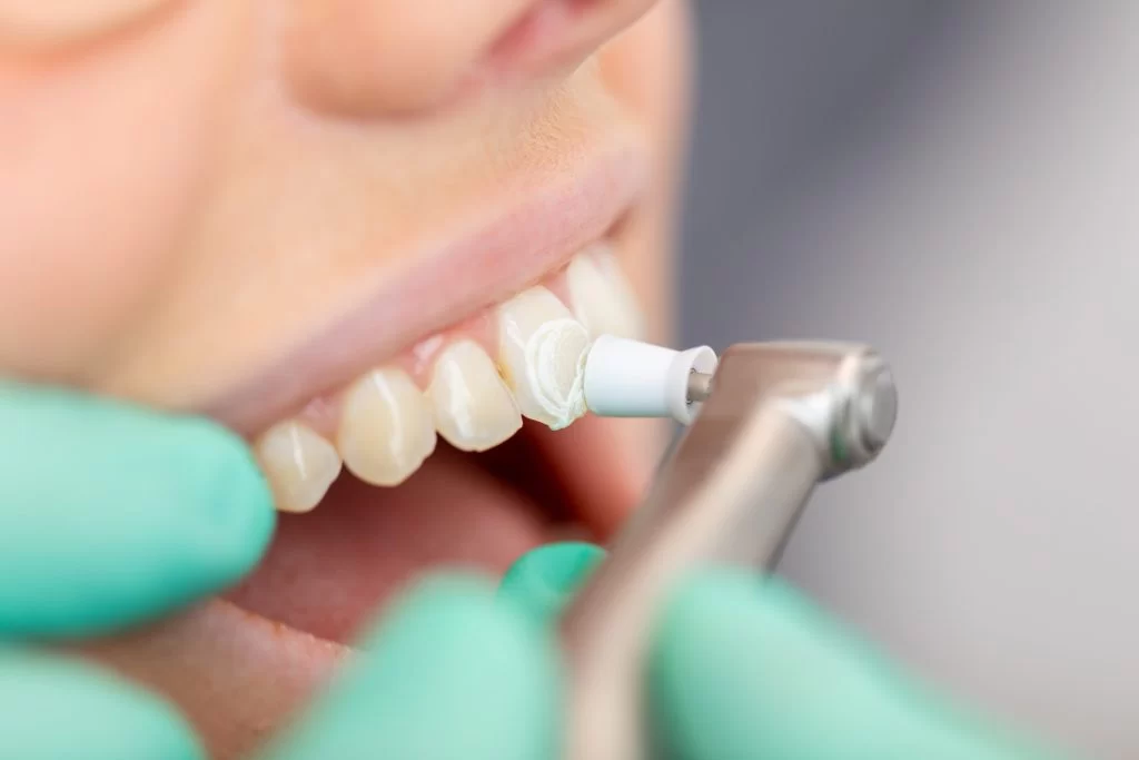 The Benefits of Cosmetic Dentistry for Aging Teeth: Restore Your Smile with Confidence