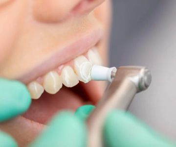The Benefits of Cosmetic Dentistry for Aging Teeth: Restore Your Smile with Confidence