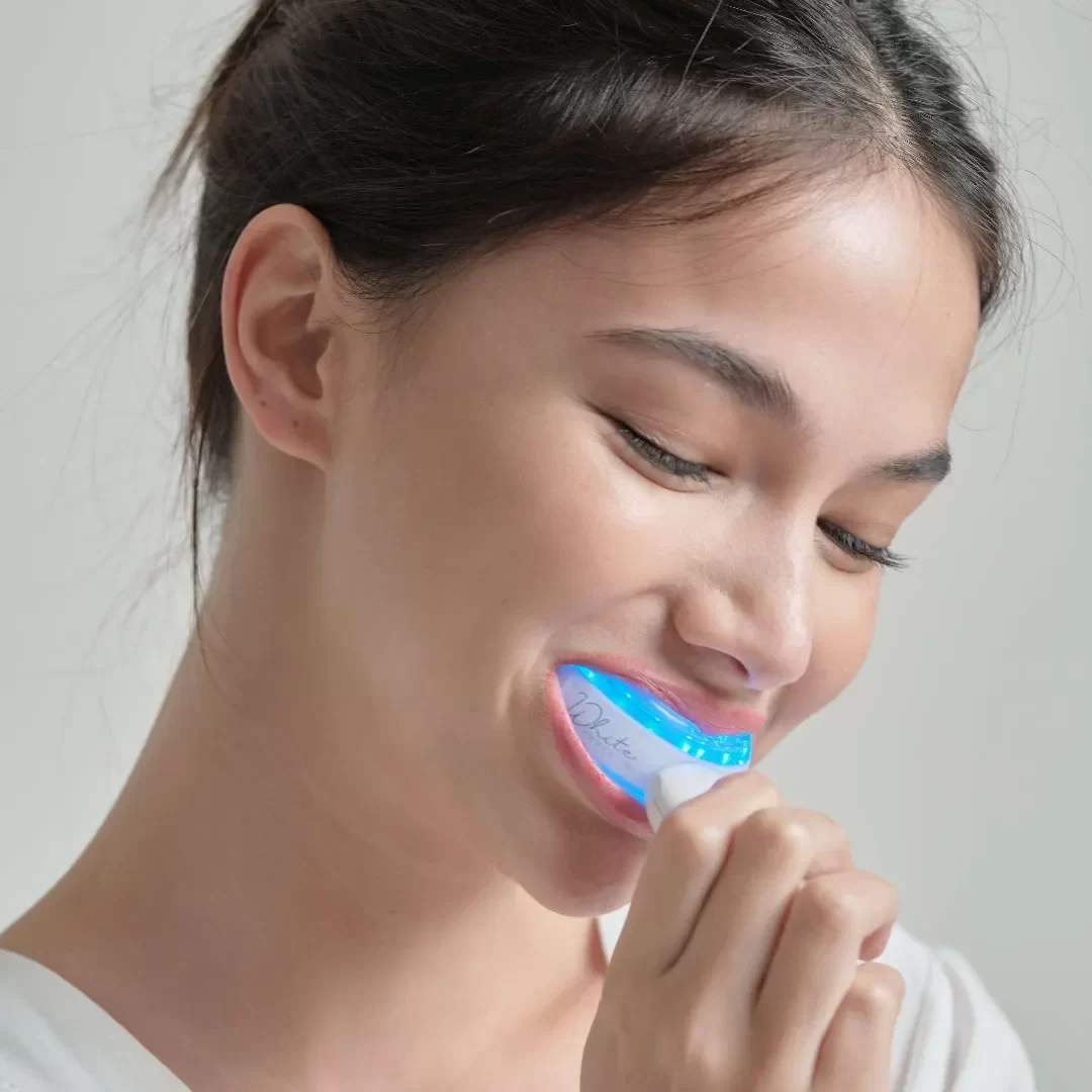 Best Over-the-Counter Teeth Whitening Products for a Brighter Smile
