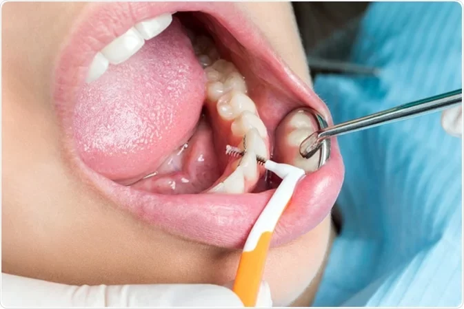 How to Take Care of Your Teeth During Pregnancy
