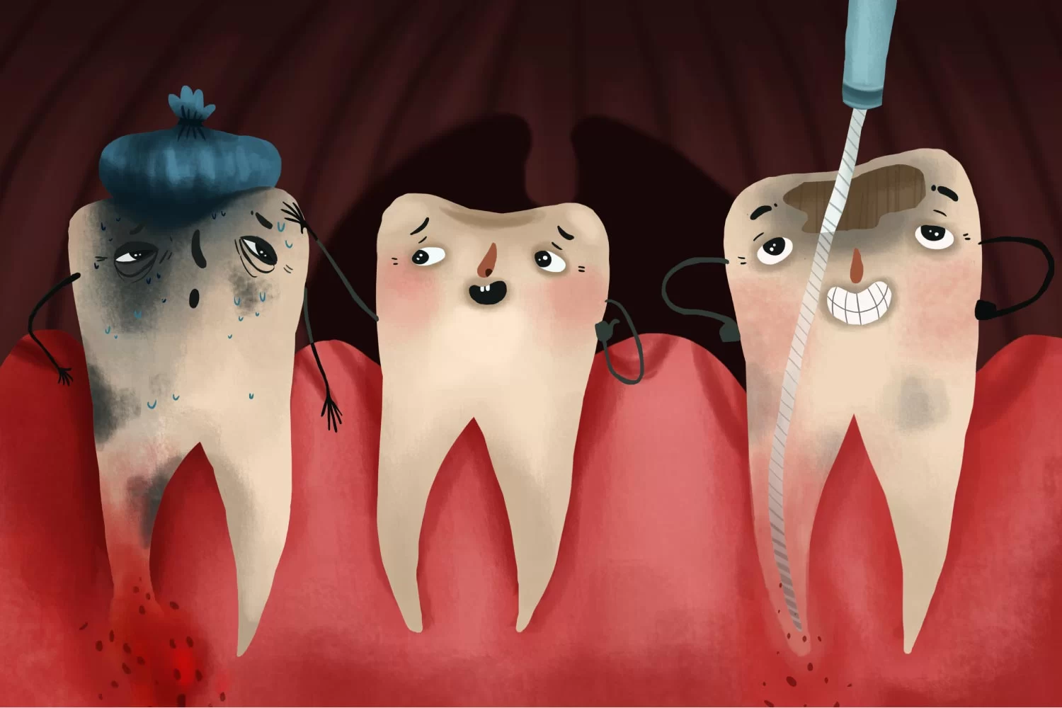 Tooth Decay in Molars: How to Prevent and Treat Molar Cavities
