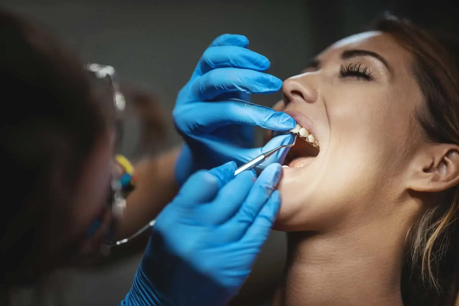 The Complete Guide to the Dental Bonding Process: How It Works and What to Expect