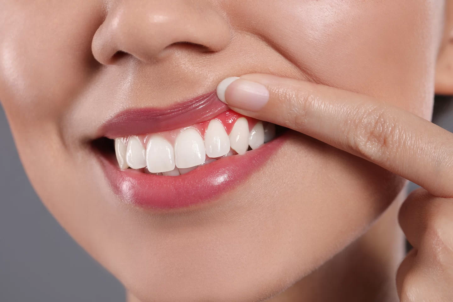 Post-Treatment Care for Gum Disease: Essential Steps for a Smooth Recovery