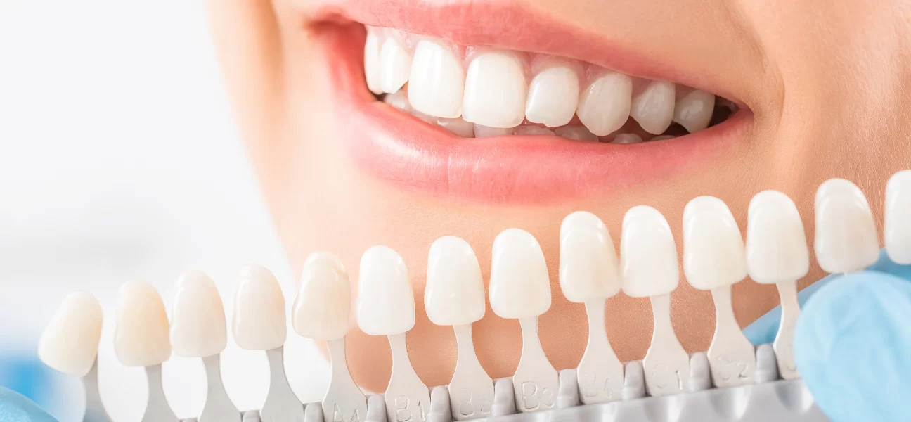 What Are the Benefits of Porcelain Crowns? A Comprehensive Guide