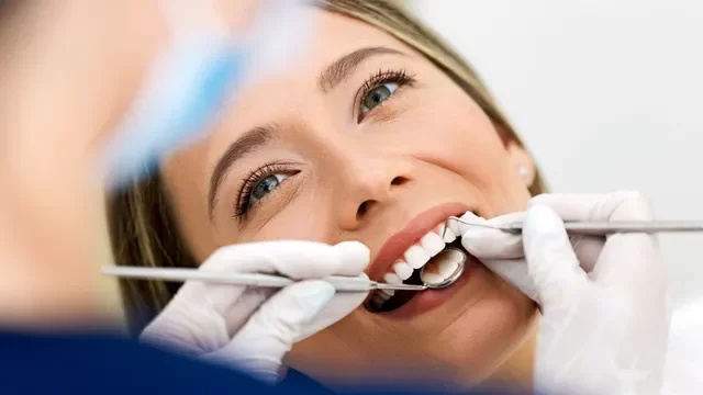 How Long Does Dental Bonding Last? Understanding Its Durability