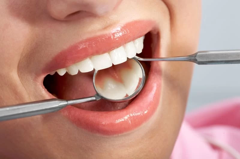 Exploring the Best Dental Filling Materials: Which Option is Right for You?