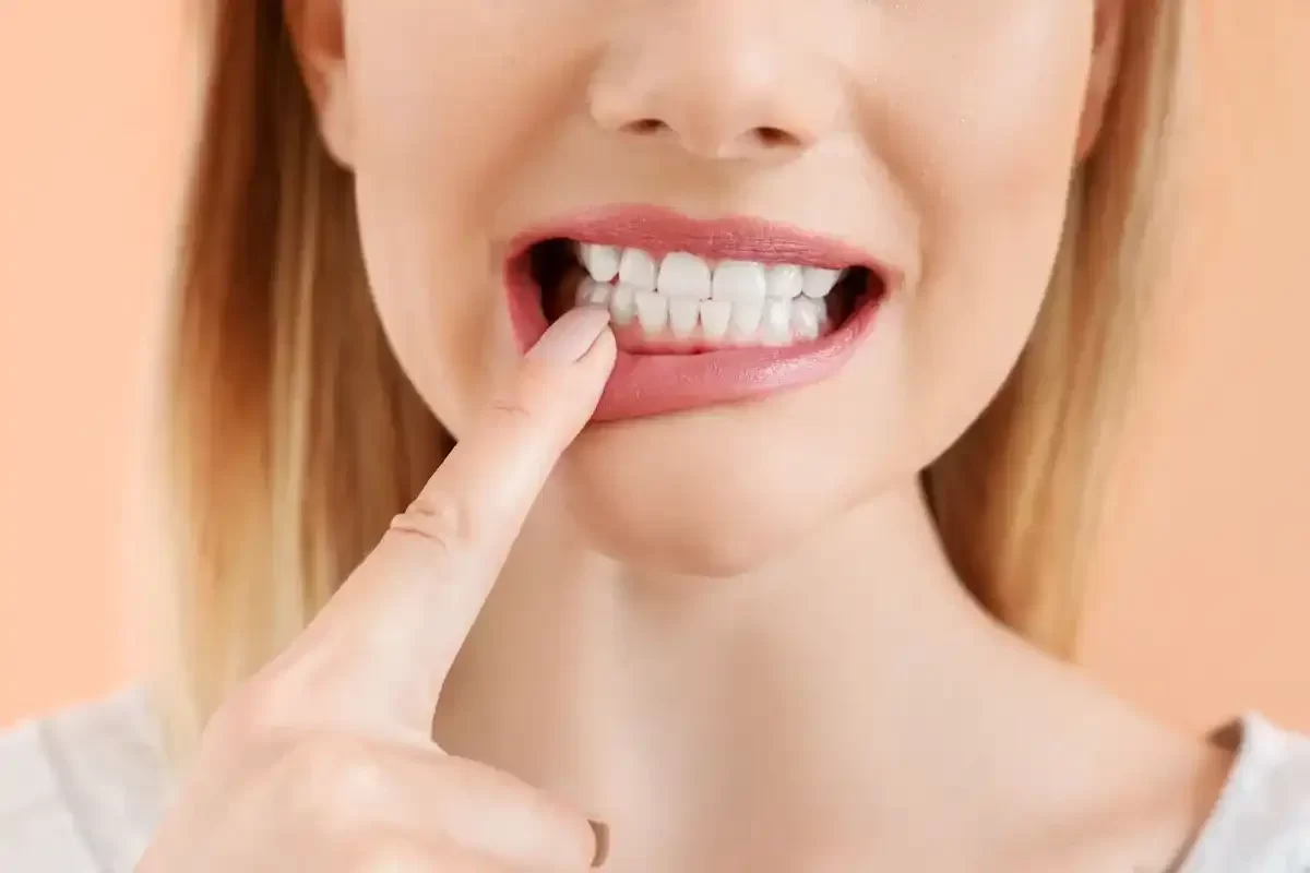 Understanding Tooth Erosion: Causes, Prevention, and Treatment for Healthy Teeth