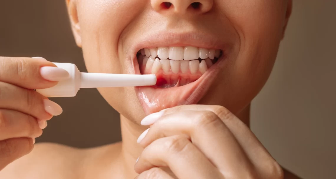 Periodontal Abscess: Symptoms, Causes, and Treatment Options