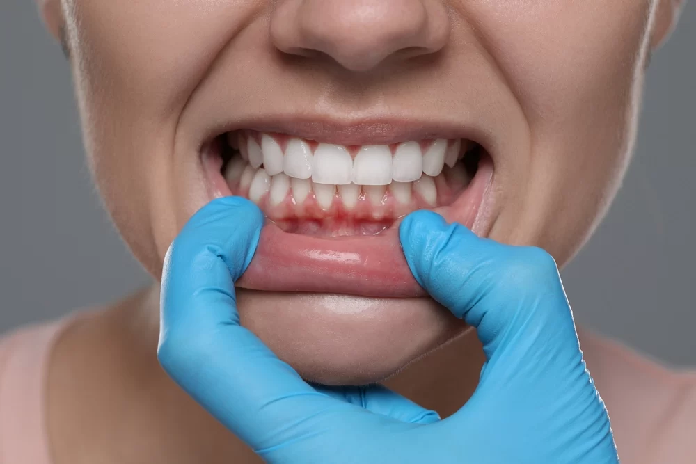 Daily Oral Care for Healthy Teeth: Essential Tips for Maintaining Your Smile