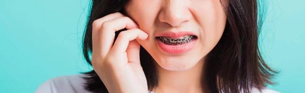How to Manage Tooth Decay While Wearing Braces – Essential Tips for Healthy Teeth