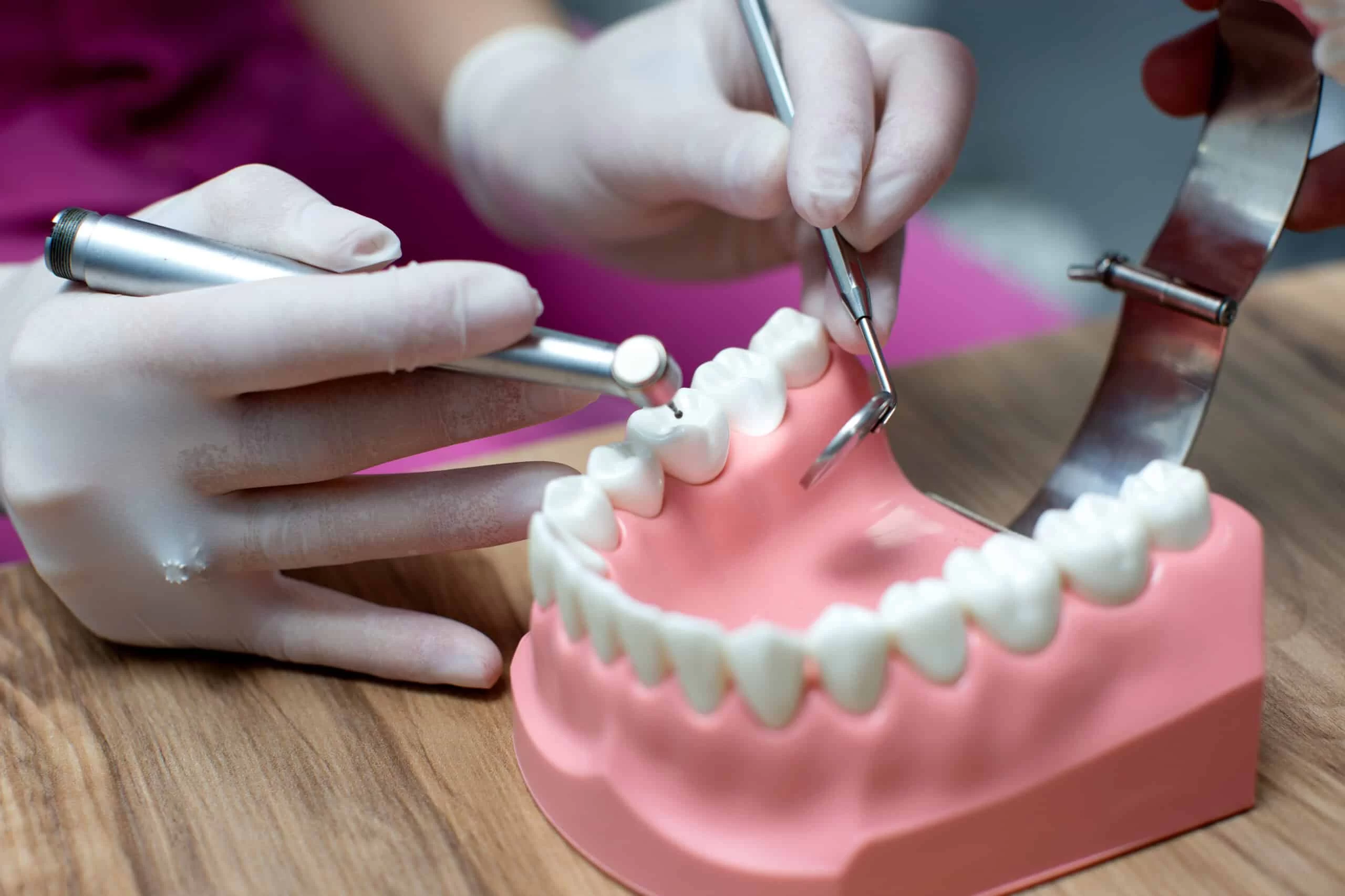 What to Do If Your Dental Crown Falls Off: Step-by-Step Guide for Quick Action