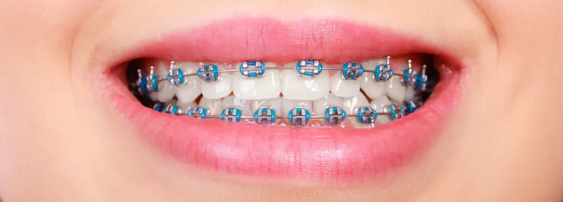 How Much Do Dental Implants Cost? A Comprehensive Guide to Pricing and Factors