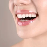 How to Fix a Gap in Teeth Without Braces
