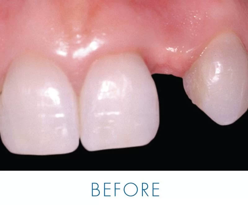 Implant Dentistry Centre Picture 4