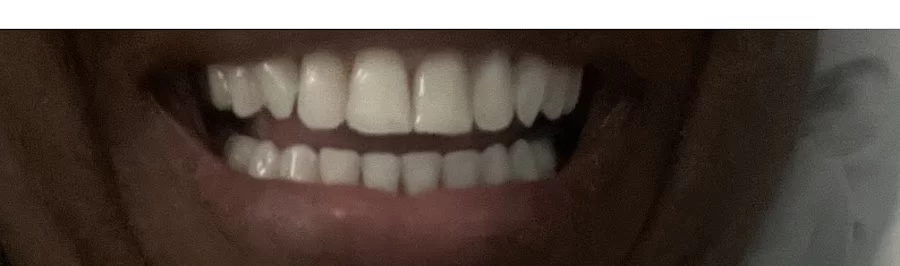 Gentle Dental Jamaica Plain Picture 7