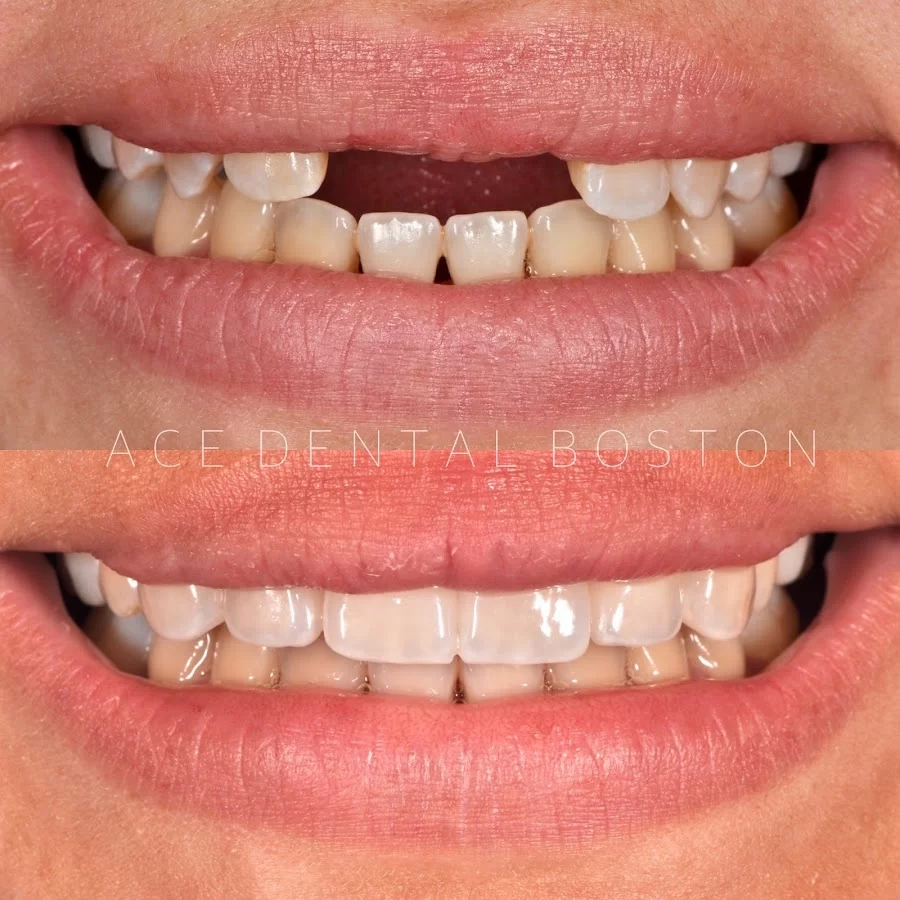 Ace Dental Boston- Hyde Park Picture 2