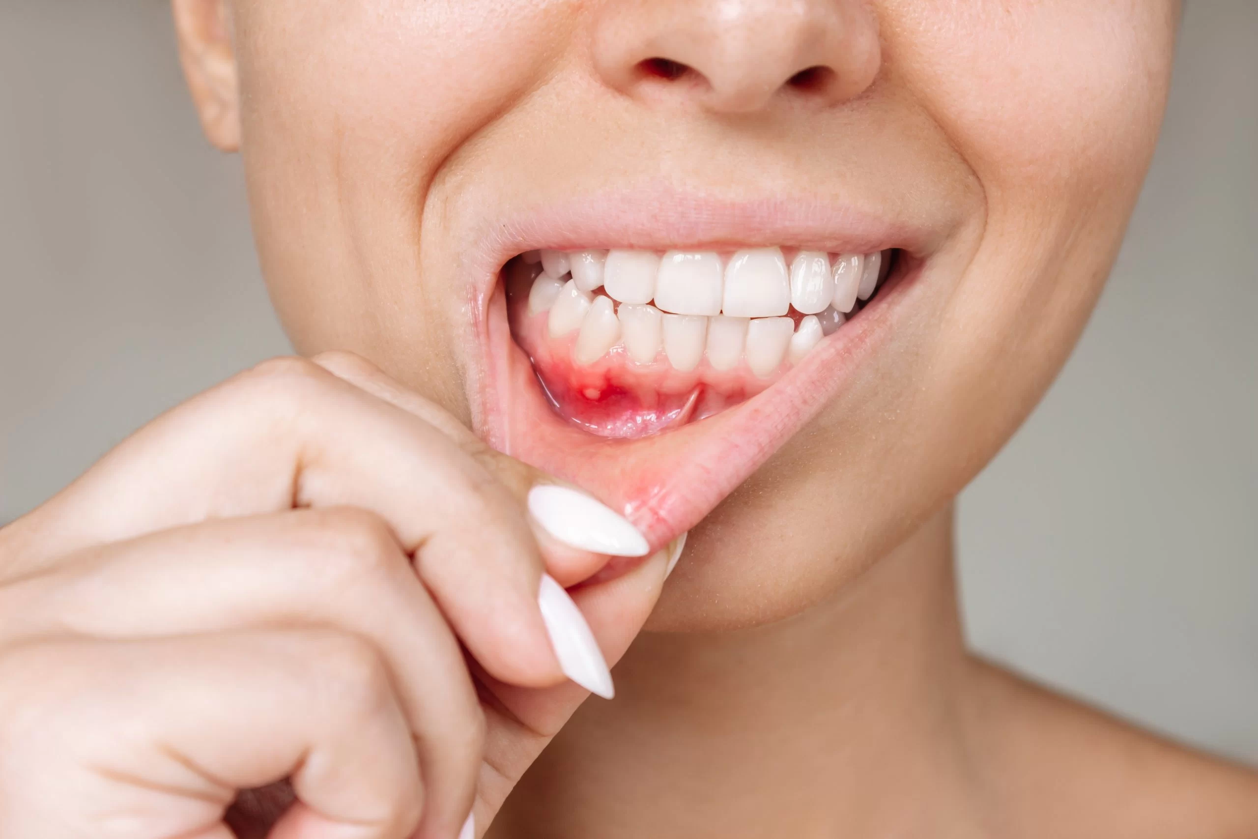 Can Gum Disease Cause a Sore Tongue? – Understanding the Connection