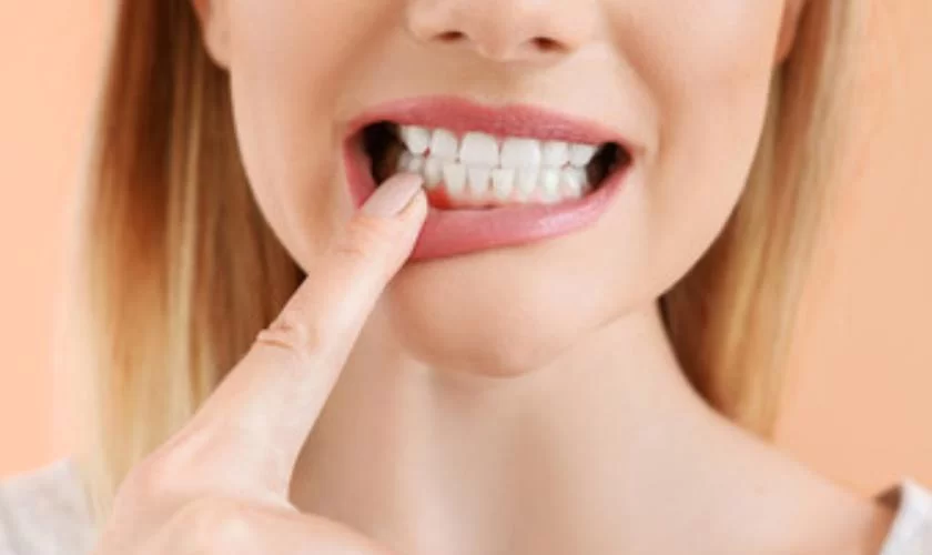Can Untreated Gum Disease Cause Tooth Loss? – Understand the Risks and Prevention