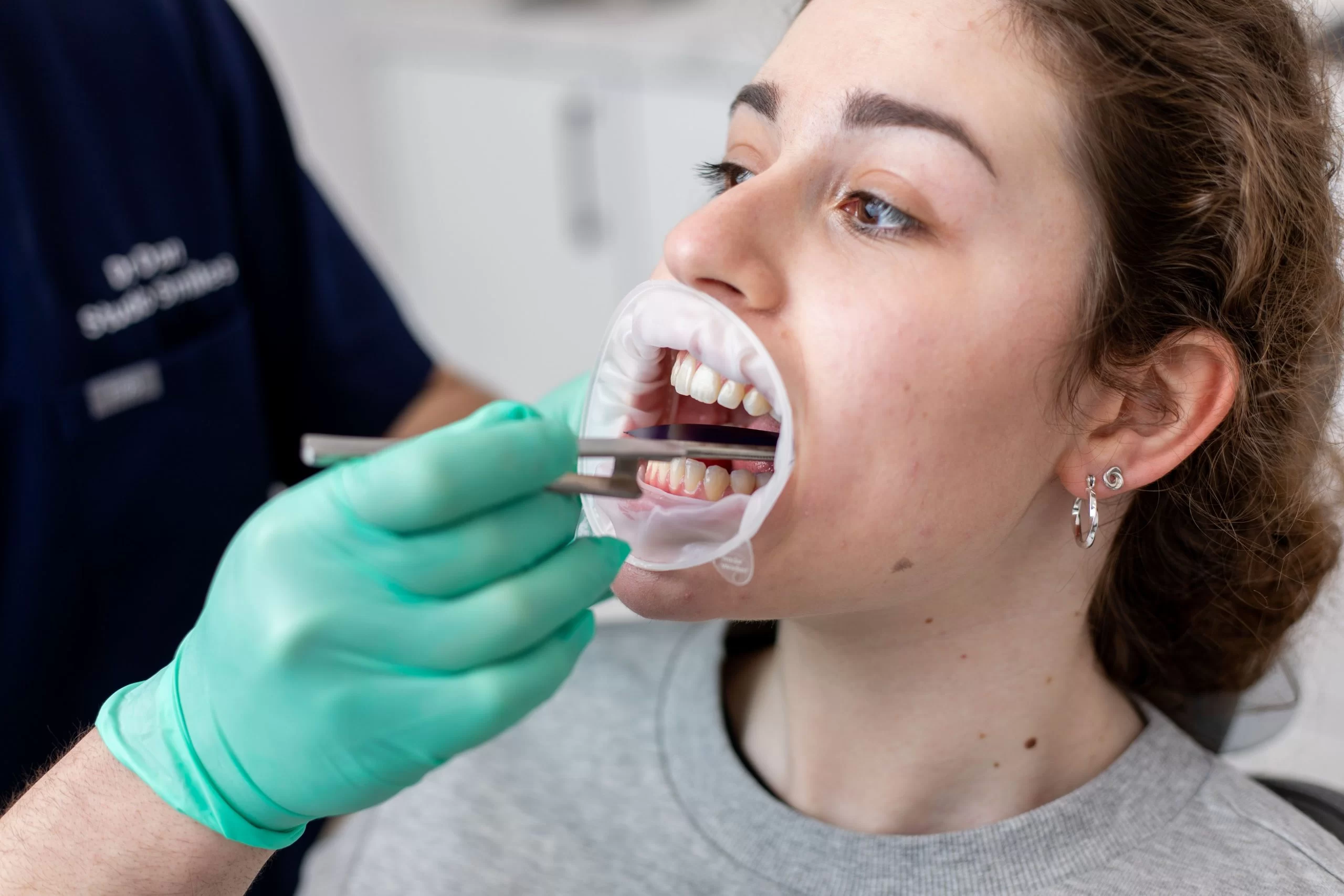 Tooth Extraction Recovery Time and Aftercare – Your Complete Guide