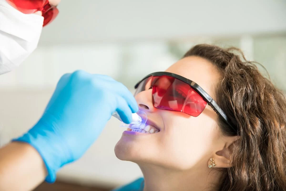 What to Expect During a Teeth Whitening Session: Step-by-Step Guide