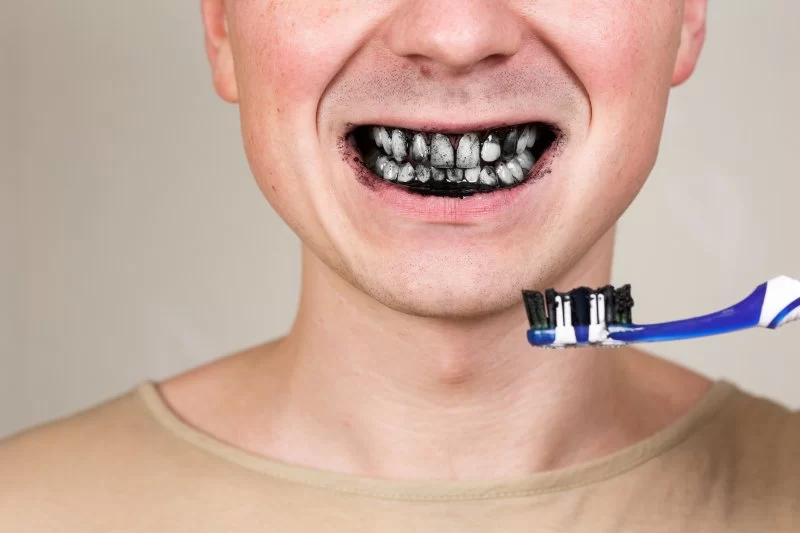 The Dangers of DIY Teeth Whitening: What You Need to Know Before Trying It