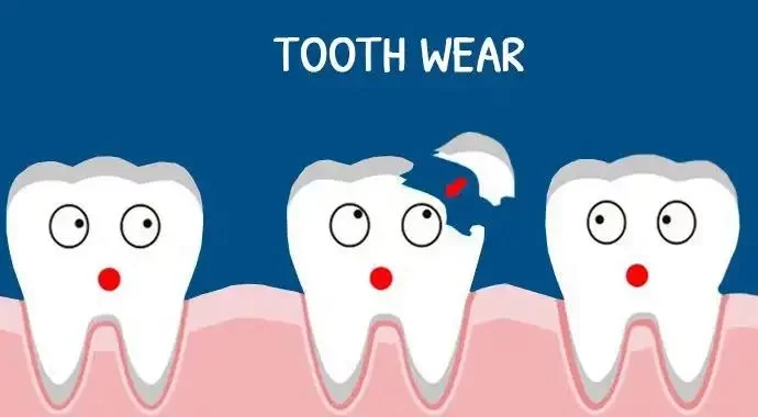 How to Avoid Enamel Wear and Tear: Essential Tips for Protecting Your Teeth