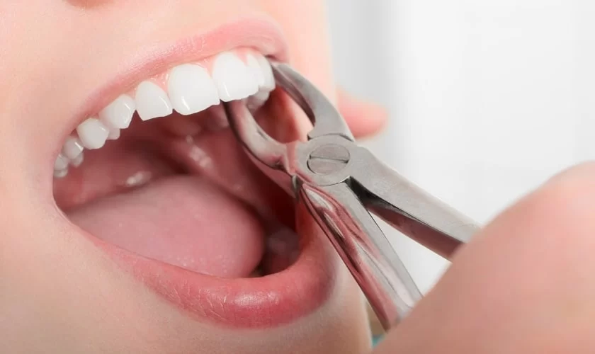 Gum Care After Dental Procedures: How to Ensure Proper Healing