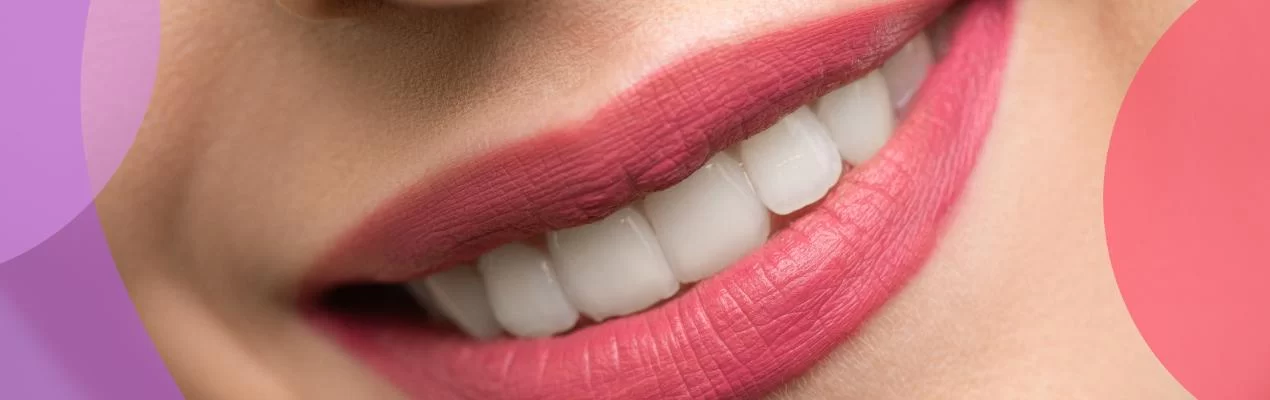 Does Dental Insurance Cover Whitening Treatments? Find Out What’s Covered