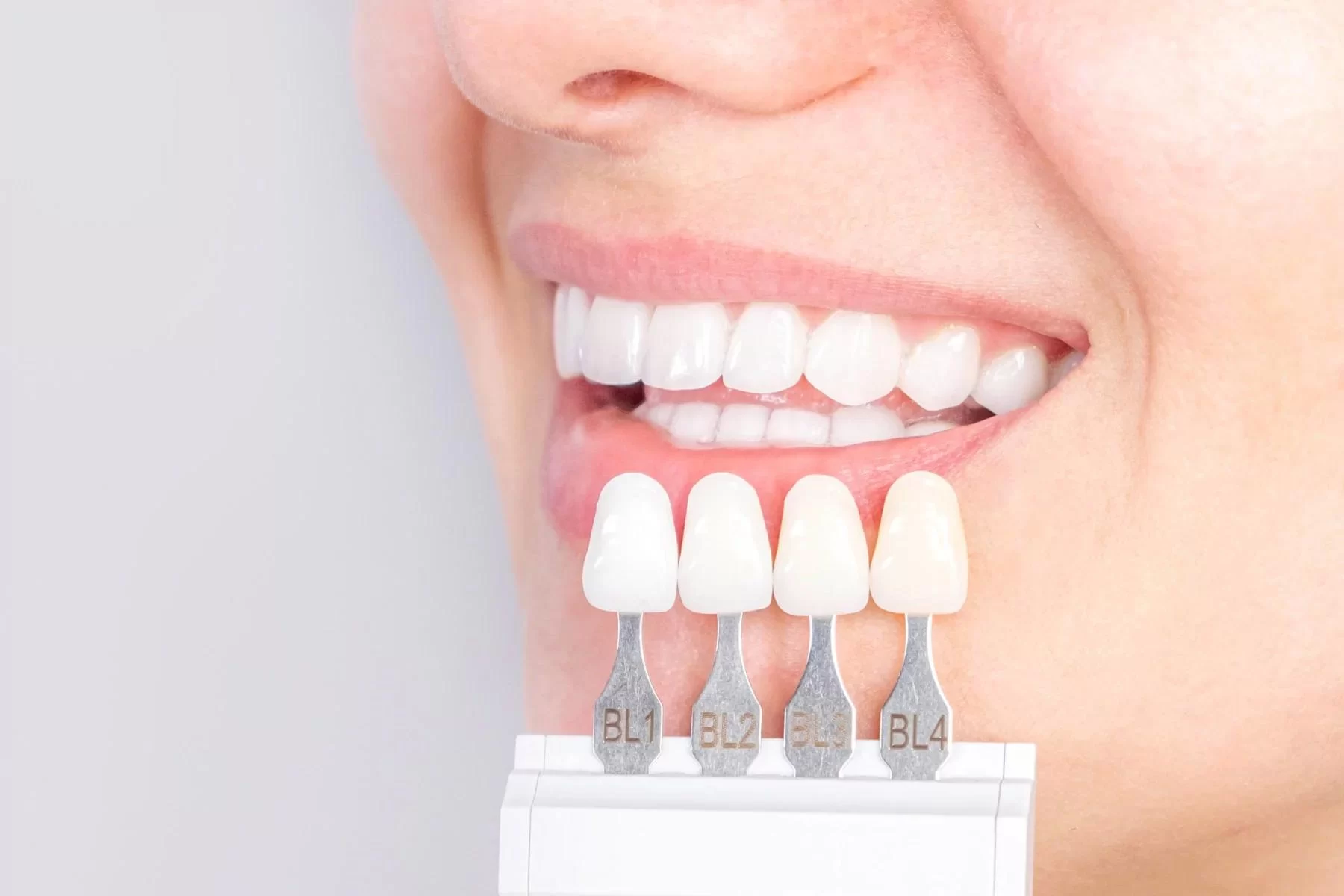 Advantages of Porcelain Dental Restorations