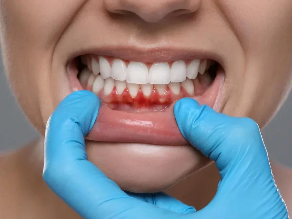 How to Prevent Gum Disease with Better Oral Care: Tips for Healthy Gums