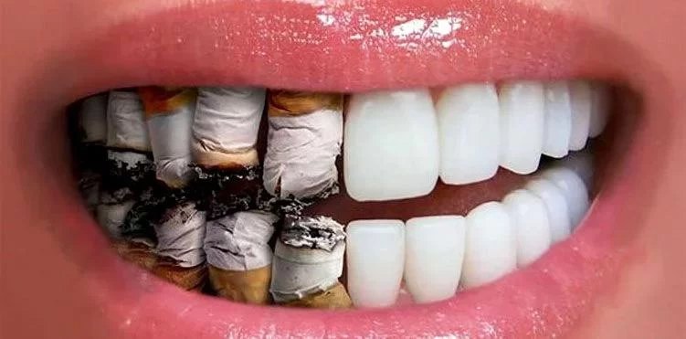 The Impact of Smoking on Your Teeth: How Smoking Affects Your Oral Health