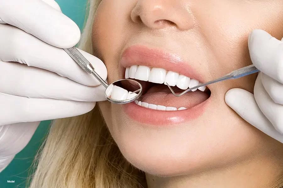 Does Dental Insurance Cover Veneers? A Complete Guide to Dental Veneer Insurance Coverage