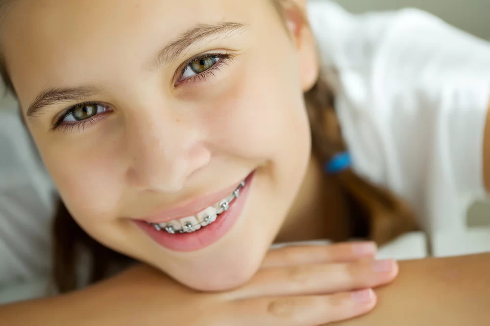 Tips for Adults with Braces: Essential Advice for a Comfortable and Successful Treatment
