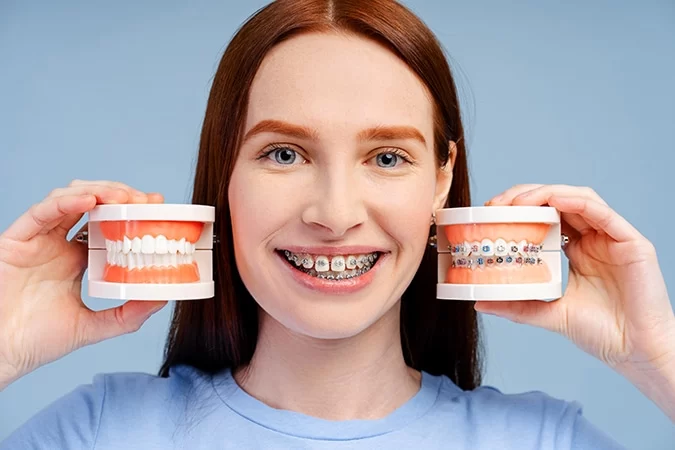 What Is the Best Dental Plan for Someone with Braces? Coverage & Costs