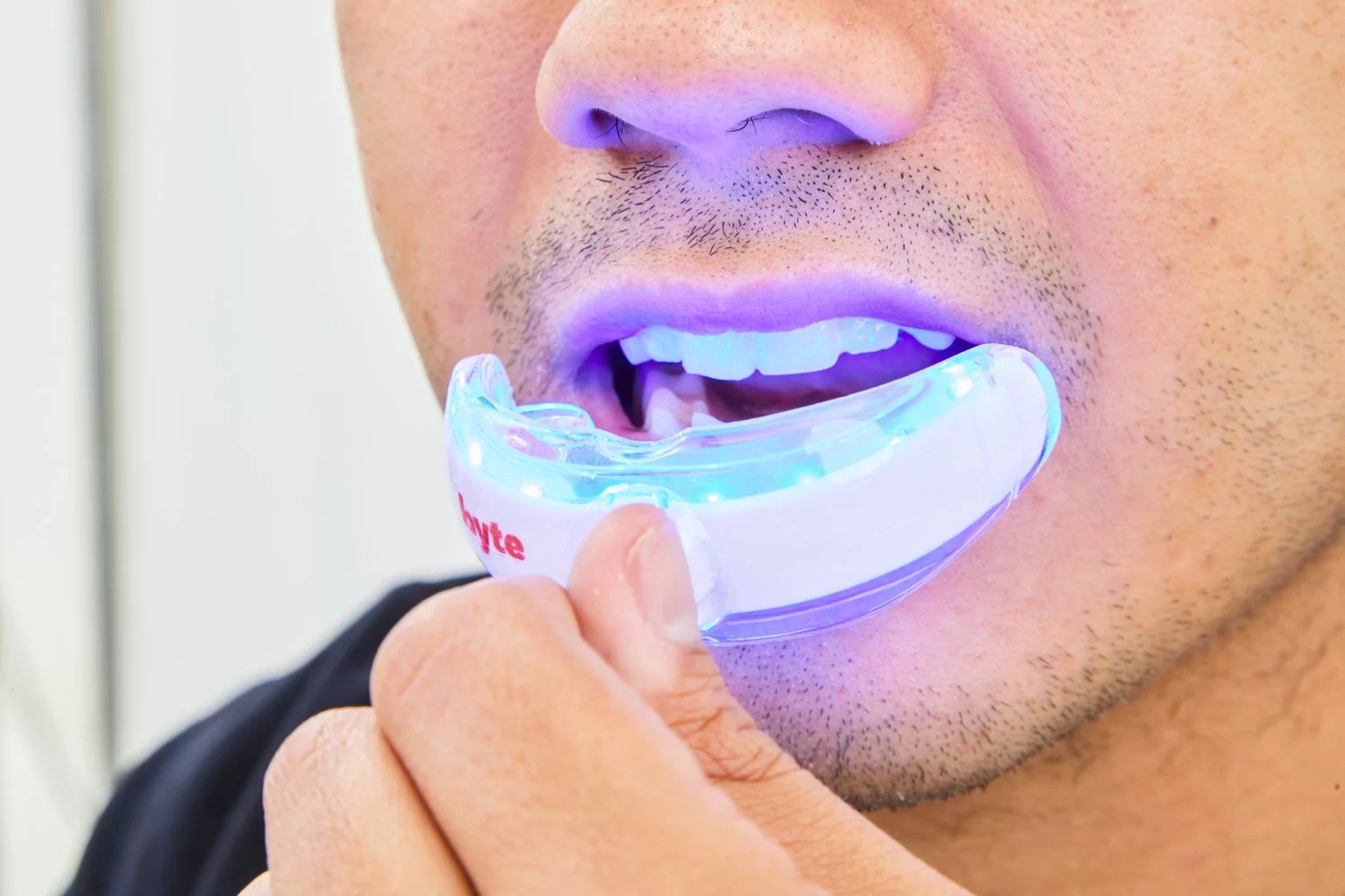 Best Options for Teeth Whitening for Sensitive Teeth – Effective Solutions for a Brighter Smile