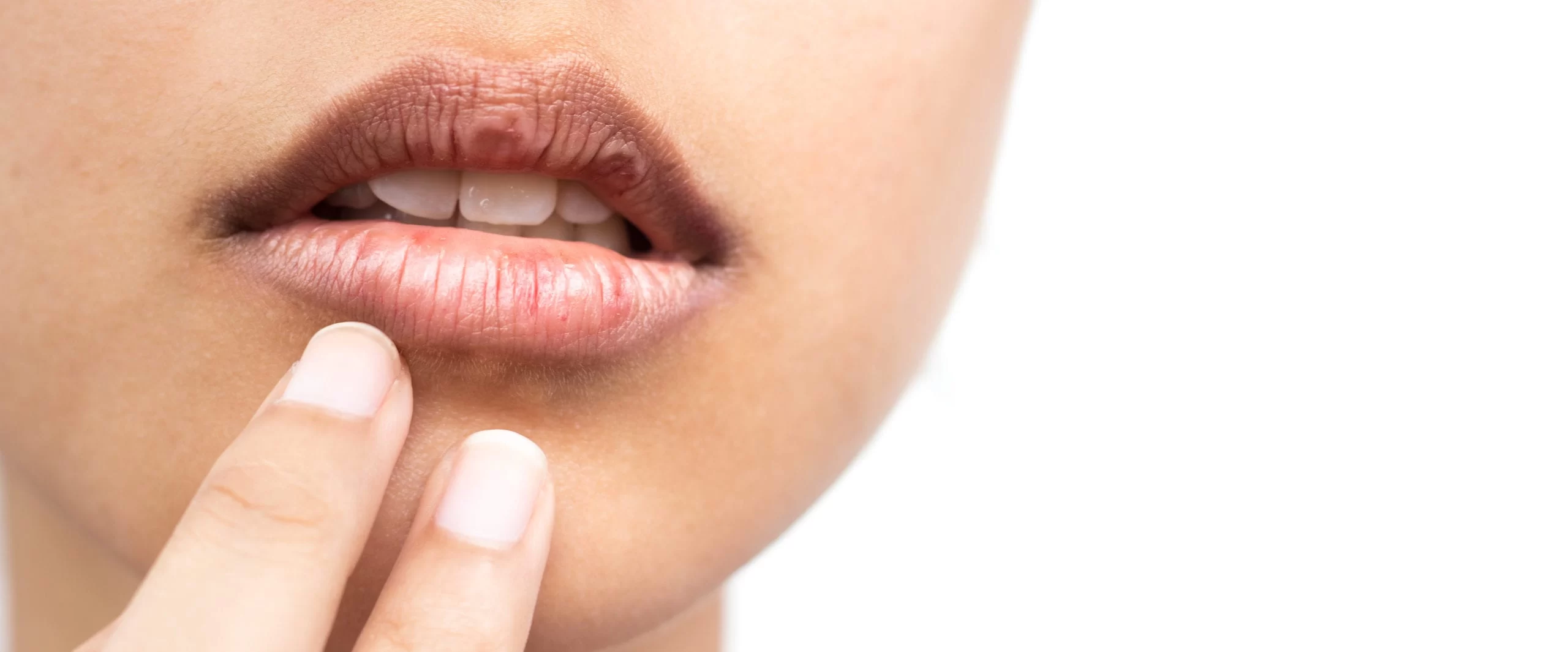The Best Treatment for Dry Mouth: Effective Solutions and Remedies