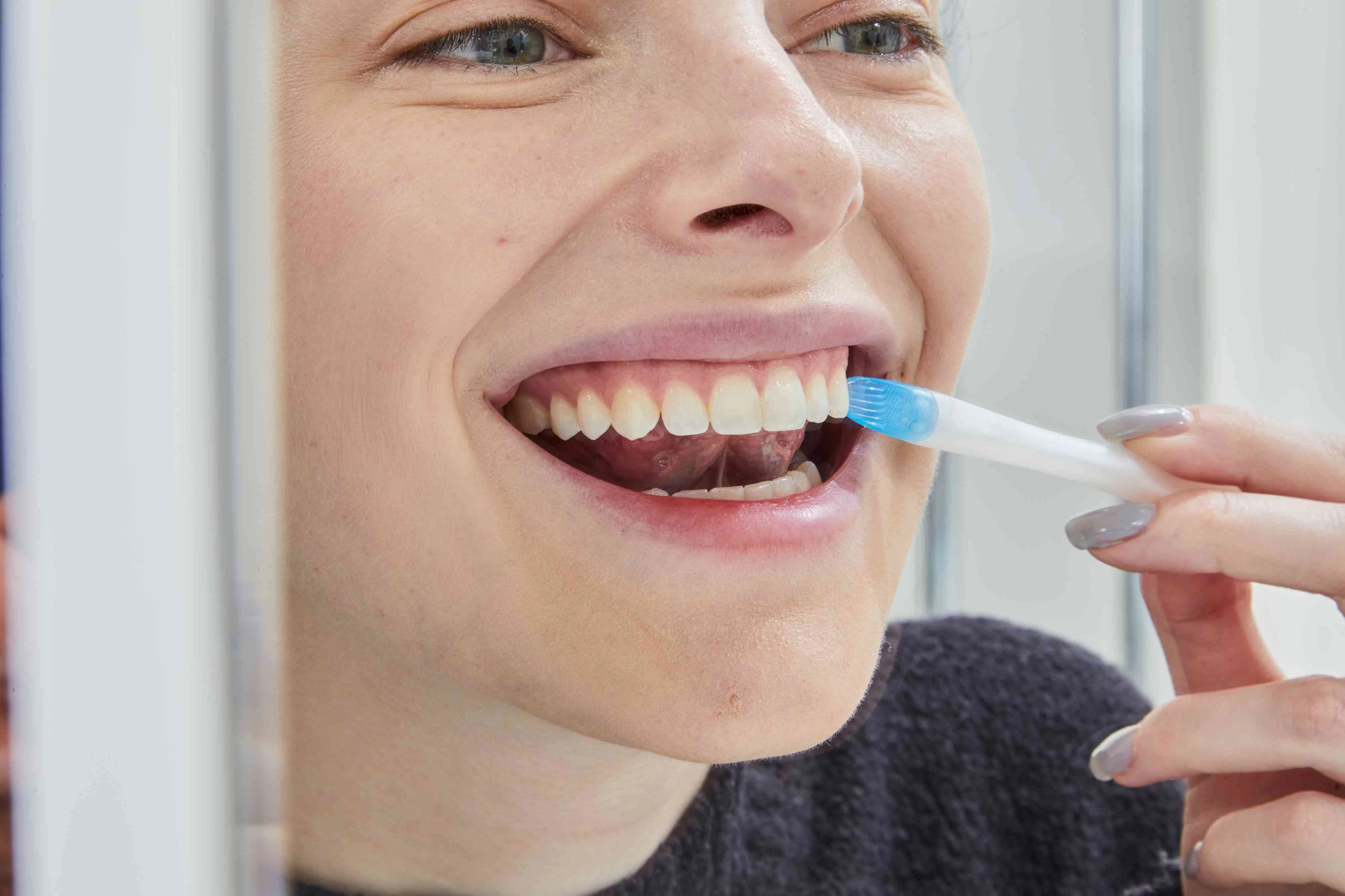 The Best Whitening Treatment for Teeth: Top Options and Effective Solutions