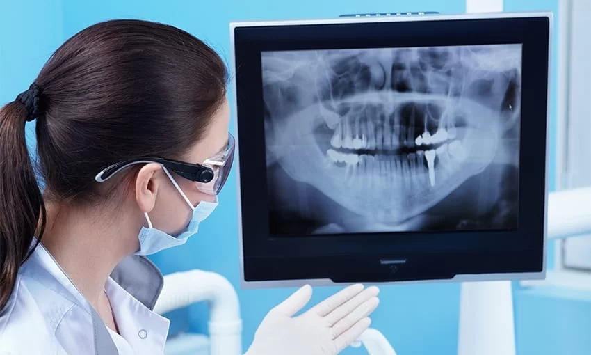 Understanding the Benefits of Digital X-rays in Dentistry – Revolutionizing Dental Care